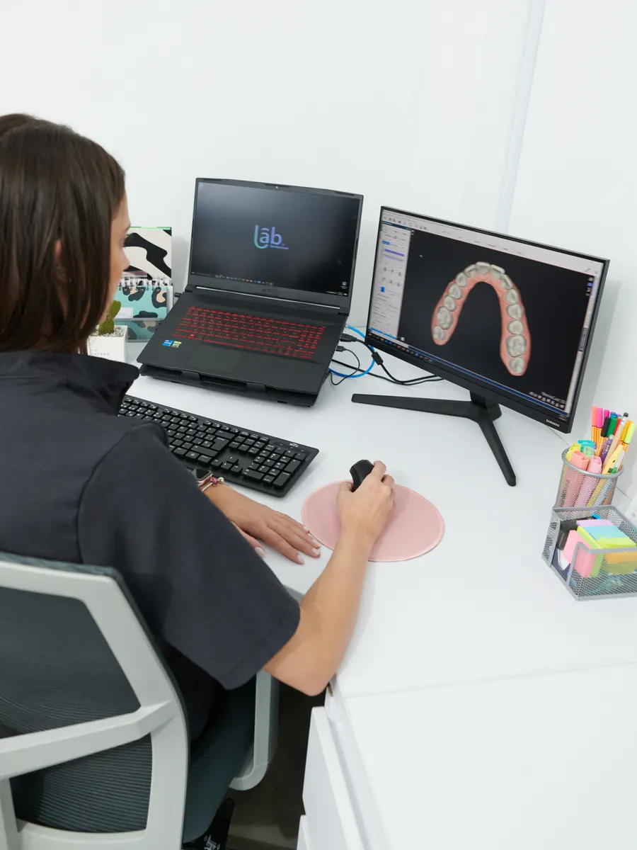 Paso 2, en el laboratorio 3D: el modelo digital de una arcada en pantalla
